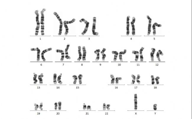 iPSC-EGFP-KI細(xì)胞模型